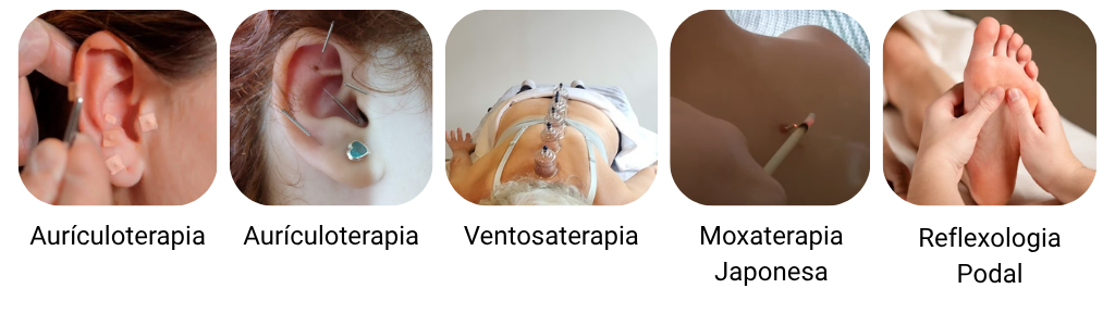 Aurículoterapia Aurículoterapia Ventosaterapia Moxaterapia Japonesa Reflexologia Podal